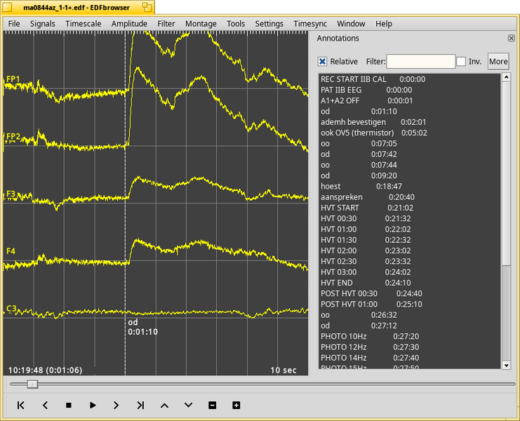 Schermata di edfbrowser